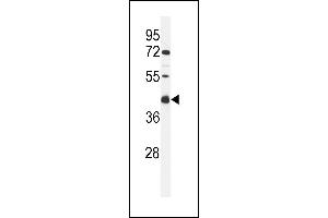 Western blot analysis of C Antibody (C-term) (ABIN653956 and ABIN2843176) in MCF-7 cell line lysates (35 μg/lane). (C9ORF91 anticorps  (C-Term))