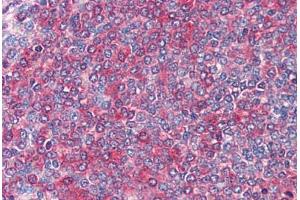 Spleen: Formalin-Fixed, Paraffin-Embedded (FFPE) (FZD7 anticorps  (AA 559-572))
