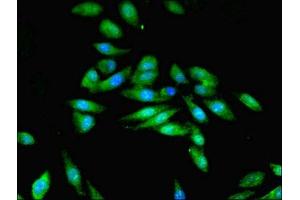 Immunofluorescent analysis of Hela cells using ABIN7168993 at dilution of 1:100 and Alexa Fluor 488-congugated AffiniPure Goat Anti-Rabbit IgG(H+L)