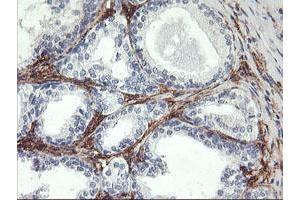 Image no. 3 for anti-Glutamyl Aminopeptidase (Aminopeptidase A) (ENPEP) antibody (ABIN1498029)