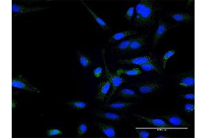 Immunofluorescence of purified MaxPab antibody to ZFYVE16 on HeLa cell.