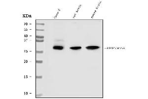 Western blot analysis of DARPP32 using anti-DARPP32 antibody (ABIN3044534).