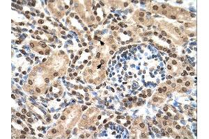 Immunohistochemistry (IHC) image for anti-Interferon-Induced Protein with Tetratricopeptide Repeats 3 (IFIT3) (N-Term) antibody (ABIN2782443) (IFIT3 anticorps  (N-Term))