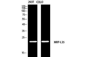Western Blot (WB) analysis of 293T COLO205 using MRP-L35 antibody. (MRPL35 anticorps)