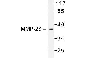 Image no. 1 for anti-Matrix Metallopeptidase 23 (MMP23) antibody (ABIN265530) (Matrix Metallopeptidase 23 (MMP23) anticorps)