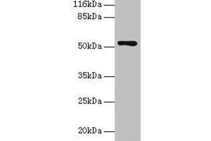 Western blot All lanes: CCDC14 antibody at 2 μg/mL + Jurkat whole cell lysate Secondary Goat polyclonal to rabbit IgG at 1/10000 dilution Predicted band size: 107, 84, 89, 52, 102 kDa Observed band size: 52 kDa (CCDC14 anticorps  (AA 159-440))