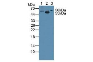 Figure. (ANTXR2 anticorps  (AA 34-318))