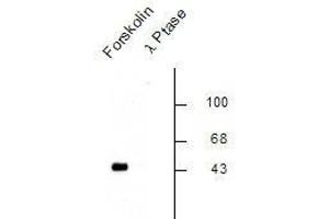Image no. 1 for anti-cAMP Responsive Element Binding Protein 1 (CREB1) (pSer133) antibody (ABIN228620)