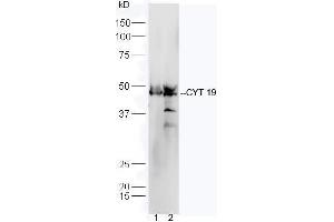 Line1, mouse heart lysate; Line2, mouse liver lysate probed with Rabbit Anti-CYT19 Polyclonal Antibody, Unconjugated (ABIN2559676) at 1:300 in 4˚C. (AS3MT anticorps  (AA 21-120))