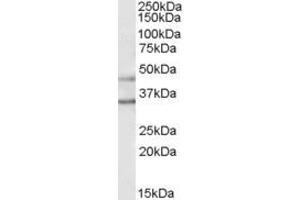 Western Blotting (WB) image for anti-Potassium Inwardly-Rectifying Channel, Subfamily J, Member 6 (KCNJ6) (C-Term) antibody (ABIN2465762) (KCNJ6 anticorps  (C-Term))