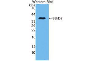 Western blot analysis of recombinant Rat EGF. (EGF anticorps  (AA 974-1026))