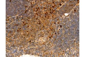 ABIN6264374 and ABIN6272975 at 1/100 staining Mouse thymus tissue by IHC-P. (PPAT anticorps  (N-Term))