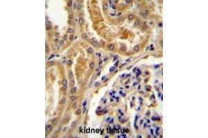TLL2 Antibody (Center) immunohistochemistry analysis in formalin fixed and paraffin embedded human kidney tissue followed by peroxidase conjugation of the secondary antibody and DAB staining.