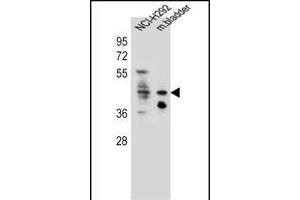 GHSR Antibody (C-term) (ABIN655816 and ABIN2845240) western blot analysis in NCI- cell line and mouse bladder tissue lysates (35 μg/lane). (GHSR anticorps  (C-Term))