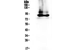Western blot analysis of Prothrombin  using anti-Prothrombin  antibody .