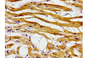 Immunohistochemistry of paraffin-embedded human heart tissue using ABIN7143334 at dilution of 1:100 (ADCY6 anticorps  (AA 9-118))