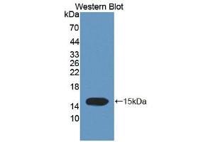 Western blot analysis of the recombinant protein. (Trichohyalin anticorps  (AA 1851-1943))