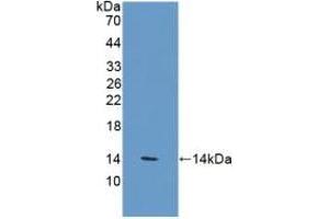 Detection of Recombinant VNN1, Human using Polyclonal Antibody to Vanin 1 (VNN1)