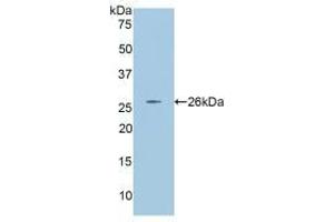 Western blot analysis of recombinant Rat ANGPT2. (Angiopoietin 2 anticorps  (AA 33-243))