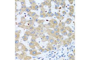 Immunohistochemistry of paraffin-embedded human liver using NMU antibody (ABIN5975084) at dilution of 1/100 (40x lens). (Neuromedin U anticorps)
