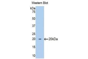 Western Blotting (WB) image for anti-Ribophorin 1 (RPN1) (AA 24-179) antibody (ABIN1175818) (RPN1 anticorps  (AA 24-179))