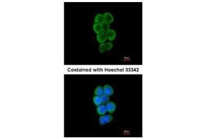ICC/IF Image Immunofluorescence analysis of methanol-fixed A431, using CBL, antibody at 1:50 dilution. (CBL anticorps  (C-Term))