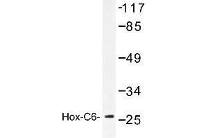 Image no. 1 for anti-Homeobox C6 (HOXC6) antibody (ABIN272159) (Homeobox C6 anticorps)