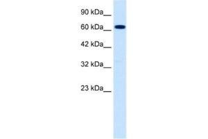 Western Blotting (WB) image for anti-Sodium Channel, Nonvoltage-Gated 1, beta (SCNN1B) antibody (ABIN2461078)