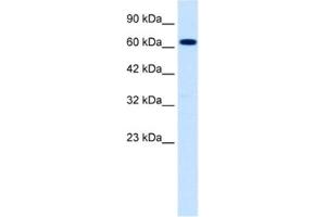Western Blotting (WB) image for anti-Sodium Channel, Nonvoltage-Gated 1, beta (SCNN1B) antibody (ABIN2461078) (SCNN1B anticorps)