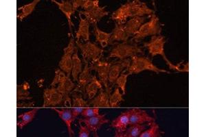 Immunofluorescence analysis of C6 cells using ADAM12 Polyclonal Antibody at dilution of 1:100.