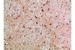 Immunohistochemical analysis of paraffin-embedded human-brain, antibody was diluted at 1:200