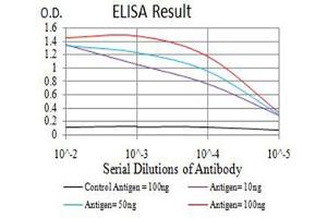 Black line: Control Antigen (100 ng),Purple line: Antigen (10 ng), Blue line: Antigen (50 ng), Red line:Antigen (100 ng) (AEBP2 anticorps  (AA 358-495))