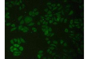 Detection of PFKP in Human Hela Cells using Polyclonal Antibody to Phosphofructokinase, Platelet (PFKP)