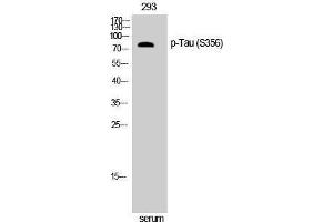 Western Blotting (WB) image for anti-tau Protein (pSer356) antibody (ABIN3179512) (tau anticorps  (pSer356))