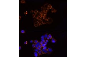 Immunofluorescence analysis of HepG2 cells using NDUFS1 Rabbit pAb (ABIN7268819) at dilution of 1:50 (40x lens).