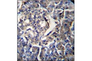 Immunohistochemistry analysis in Formalin Fixed, Paraffin Embedded Human pancreas tissue using RPL35 Antibody (C-term) followed by peroxidase conjugation of the secondary antibody and DAB staining. (RPL35 anticorps  (C-Term))