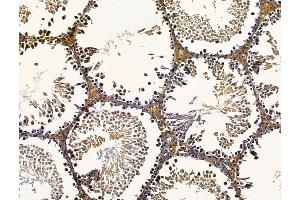 ABIN7096241 and ABIN7100303 at 1/100 staining rat testis tissue by IHC-P. (SAMD3 anticorps)