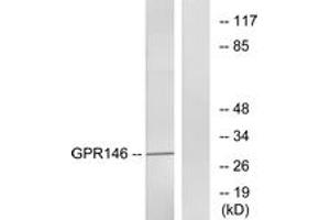 Western blot analysis of extracts from LOVO cells, using GPR146 Antibody. (GPR146 anticorps  (AA 191-240))
