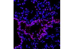 Immunofluorescence of paraffin embedded mouse lung using RBAK (ABIN7075383) at dilution of 1:400 (400x lens) (RBAK anticorps)
