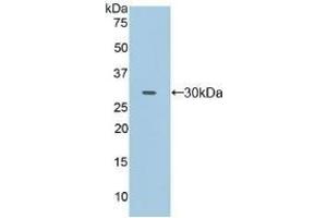 Detection of Recombinant FcgRII, Human using Polyclonal Antibody to Cluster Of Differentiation 32 (CD32) (Fc gamma RII (CD32) (AA 69-309) anticorps)