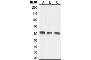 Western blot analysis of MMP15 expression in HeLa (A), mouse kidney (B), rat kidney (C) whole cell lysates. (MMP15 anticorps  (Center))