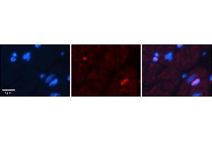 Rabbit Anti-Dpf3 Antibody  Catalog Number: ARP38943_P050 Formalin Fixed Paraffin Embedded Tissue: Human Adult heart  Observed Staining: Nuclear (not in cardiomyocytes but in fibrocytes in endomysium Primary Antibody Concentration: 1:600 Secondary Antibody: Donkey anti-Rabbit-Cy2/3 Secondary Antibody Concentration: 1:200 Magnification: 20X Exposure Time: 0. (DPF3 anticorps  (N-Term))