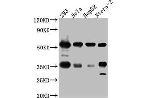 Western Blot Positive WB detected in: 293 whole cell lysate, Hela whole cell lysate, HepG2 whole cell lysate, Ntera-2 whole cell lysate All lanes: NONO Antibody at 1:1000 Secondary Goat polyclonal to rabbit IgG at 1/50000 dilution Predicted band size: 55, 44 kDa Observed band size: 55 kDa (Recombinant NONO anticorps)