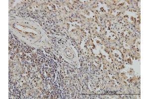 Immunoperoxidase of monoclonal antibody to BUB1B on formalin-fixed paraffin-embedded human spleen.