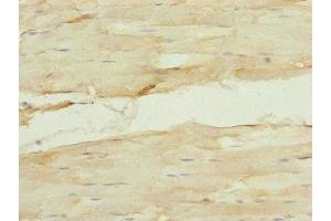 Immunohistochemistry of paraffin-embedded human skeletal muscle tissue using ABIN7157665 at dilution of 1:100