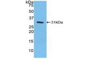 Detection of Recombinant CA3, Human using Polyclonal Antibody to Carbonic Anhydrase III, Muscle Specific (CA3) (CA3 anticorps  (AA 2-260))