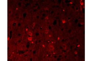 Formalin-fixed and paraffin-embedded rat brain labeled with Anti-β-catenin/Catenin β Polyclonal Antibody, Unconjugated 1:200, overnight at 4°C, The secondary antibody was Goat Anti-Rabbit IgG, PE conjugated-PE)used at 1:200 dilution for 40 minutes at 37°C.