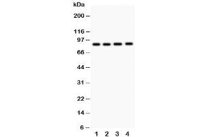 Western blot testing of NOX5 antibody and  Lane 1: 22RV1 (NOX5 anticorps  (C-Term))