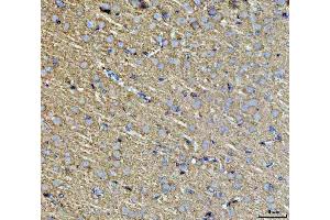 IHC analysis of Septin 3/SEPTIN3 using anti-Septin 3/SEPTIN3 antibody (ABIN7599288). (Septin 3 anticorps  (AA 1-339))