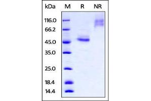 Biotinylated Human TIGIT, Fc Tag on SDS-PAGE under reducing (R) and no-reducing (NR) conditions.